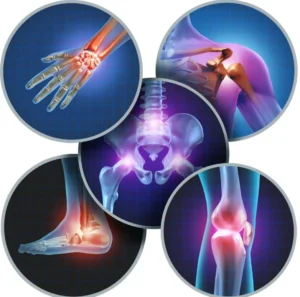 Physiotherapy for arthritis